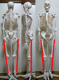 脚長差：大転子から外果までの長さ骨格模型.jpg